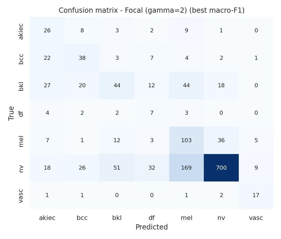 Confusion matrix of the best configuration (focal loss).